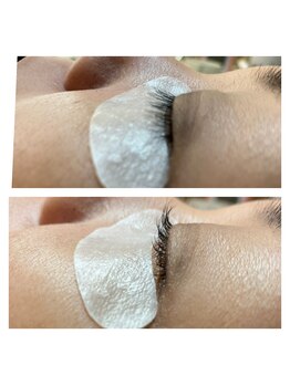 マックス(MAX)/まつパのビフォーアフター