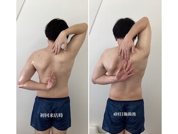 ハリサロンドオフ 堺東店(hari salon de off)/お客様before→after