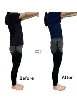 ブライトプラス(BRIGHT+)/ダイエットコース