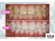 ニコ(nico)の雰囲気（セルフホワイトニングnico）