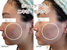 ポノ(Pono)/毎日鏡を見たくなるお肌へ♪