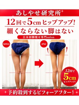 メディカルエステ 大宮店/痩身/痩身/痩身/痩身/痩身/痩身/