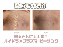 メディカルエステサロン ローズ 金沢本店(ROSE)の雰囲気(一人ひとりに合ったオーダーメイド施術で感動の結果へ)