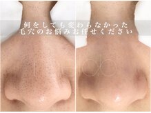 ミラボ(melab)