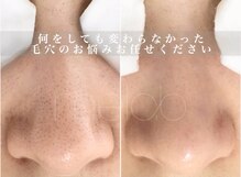 ミラボ(melab)