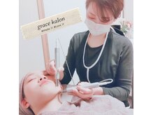 グレースカロン(grace kalon)