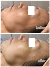 アロマ&クレイケアルーム ネロリドール(Nerolidol)/美白＆トーンアップに