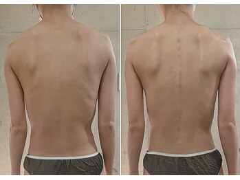 サプナジー(Suppnrgy)/カスタムトリートメント