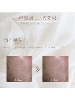 アイネイル 小倉(ai nail)/人気NO.1 トータルフェイシャル