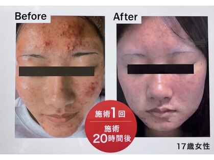 アイナ(aina)の写真