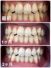 コナホワイトニング 神保町/ホワイトニング