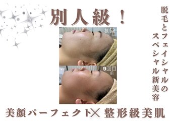 エステティック レイビス 銀座店(RAYVIS)/