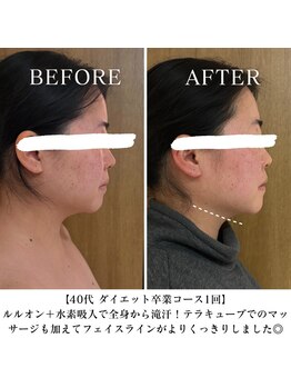 ヨサパーク エラ 恵比寿西(YOSA PARK Ella)/ダイエット卒業コース