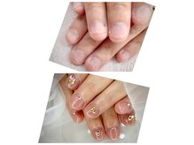ヒロネイル(Hiro Nail)の雰囲気(どんな深爪でもナチュラルに長さだし可能 持ちも◎)