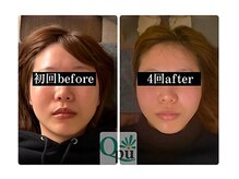 キュープ 鹿児島伊集院店(Qpu)の雰囲気（女性のための女性による小顔矯正専門店です。貴方の悩みを解決。）