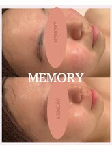 メモリー(MEMORY)/赤みやニキビが改善♪