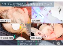 ミエリア美容鍼灸院(mielia美容鍼灸院)/カスタム電気美容鍼灸のコース