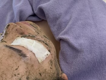 ルピナージュ(Lupinage)/ハーブピーリング