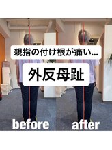 カワル整体 上通り院/【足の指が痛い...】