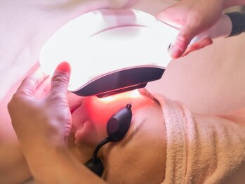 グランディール(GRANDIR)/最新光フェイシャルでシミケア