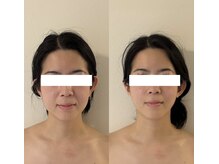 光癒(コウユ)の雰囲気（何歳からでも顔のお悩み改善できます！施術後から驚きの変化を◎）