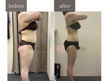 ノンノンプラス 博多(NON-NONプラス)/ビフォーアフター