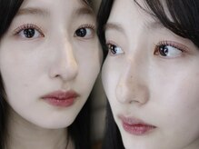 ユニ(uni)/&Healthy