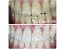 ホワイトニングルーム 横浜店(Whitening Room)/セルフホワイトニング/横浜