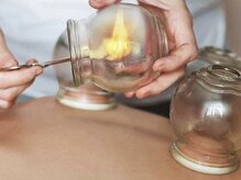 ユウフクサロン(yufuku salon)/中国式吸い玉/デトックス