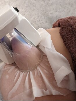 ラシュレ(Rassurer)/キャビクライオ2 脂肪冷却