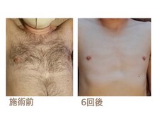 ボニータ(BONITA)/