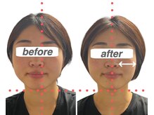 ガーデン(Garden)/小顔、バランス矯正