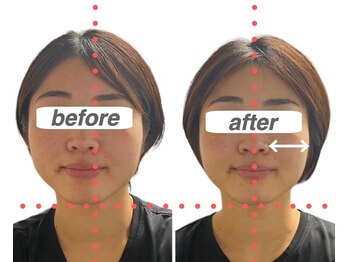 ガーデン(Garden)/小顔、バランス矯正