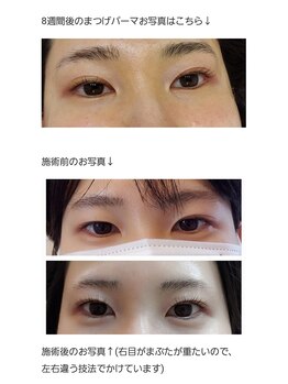 アロマスイーツ(AromaSweets)/まつげパーマ/まつ毛パーマ