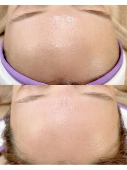 ノート(note)/フェイシャルワックス《宇都宮》