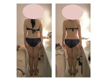 アクア エステティコ 亀有(ACQUA estetico)/痩身　脂肪燃焼　中半身　6回　