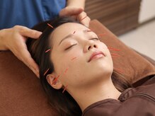 甲陽園鍼灸わたぐもの雰囲気（優しい美容鍼でお顔をスッキリ引き締める【美容鍼/リンパ】）