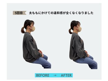 すこやか鍼灸整体院/姿勢矯正直前直後