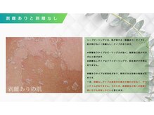 オールグッド 小倉店(ALL GOOD)/5 剥離ありと剥離なし