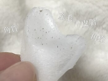 アルム(a'lm)/ワックス脱毛/フェイシャルWAX