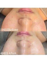 アンバー(amber)/くすみゼロ ツヤ肌