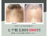 髭脱毛！都度払い◎→美容パック付き¥5,000