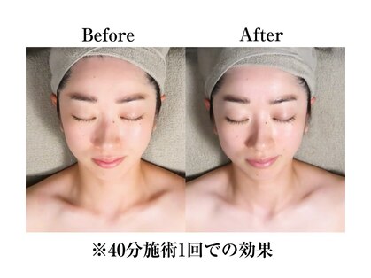 ヴィベル(vi Belle)の写真