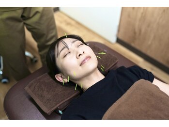 リボーン鍼灸整骨院(reborn鍼灸整骨院)/美容鍼灸コース【徹底美顔】