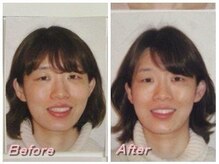 ドクター ヴィーナス/歪み改善の症例