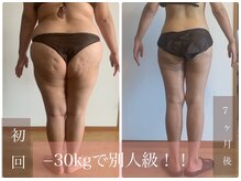 【★本気痩せ★】マシーンとバンドで全身ケア♪-30kg達成！