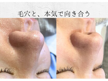 オートクチュール エステティックサロン シーズの写真