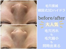 ウィア 越谷店(Uvia)の雰囲気（大人気！3Dハイドラ毛穴洗浄は圧倒的洗浄力で1回でも毛穴レス肌）