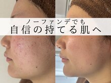 アエオボンヌール(A.E.O BONHEUR)