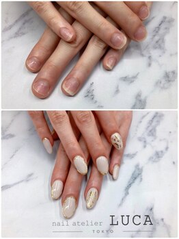 ネイルアトリエルカ(nail atelier LUCA)/W-76 深爪改善ジェルネイル